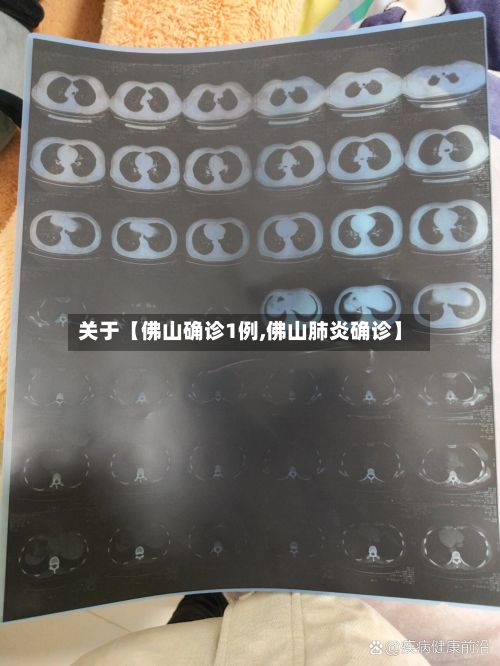 关于【佛山确诊1例,佛山肺炎确诊】