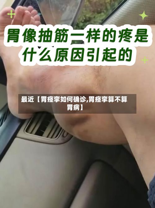 最近【胃痉挛如何确诊,胃痉挛算不算胃病】-第3张图片
