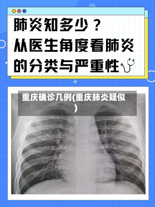 重庆确诊几例(重庆肺炎疑似)-第2张图片