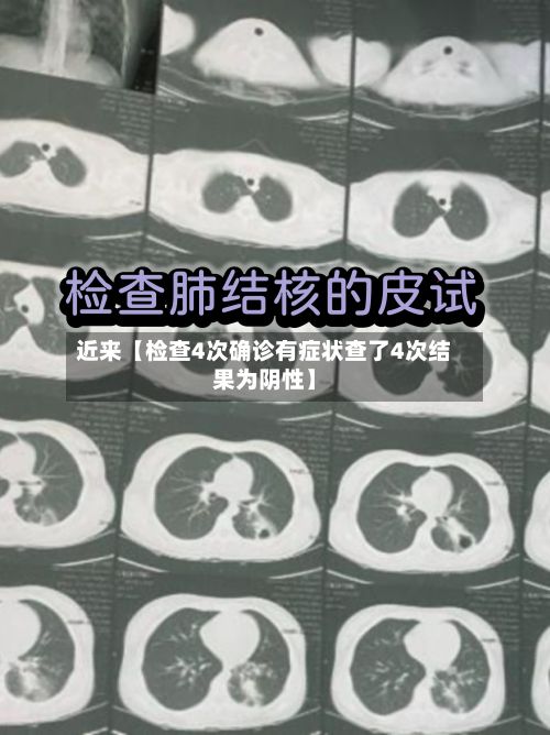 近来【检查4次确诊有症状查了4次结果为阴性】-第2张图片
